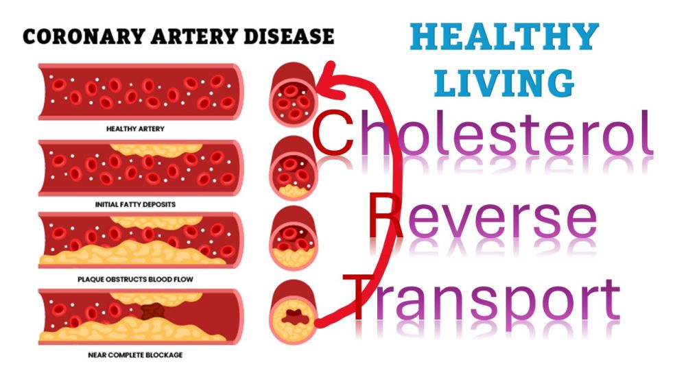 Cholesterol Reverse Transport: A Natural Defense Against Heart Disease